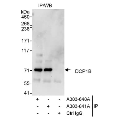 Rabbit anti-DCP1B Antibody, Affinity Purified