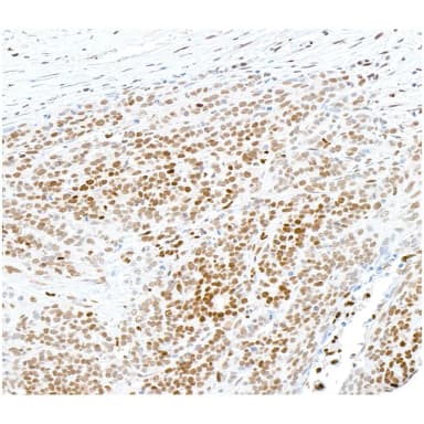 Rabbit anti-SAMHD1 Antibody, Affinity Purified