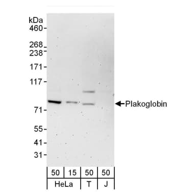 Rabbit anti-Plakoglobin Antibody, Affinity Purified