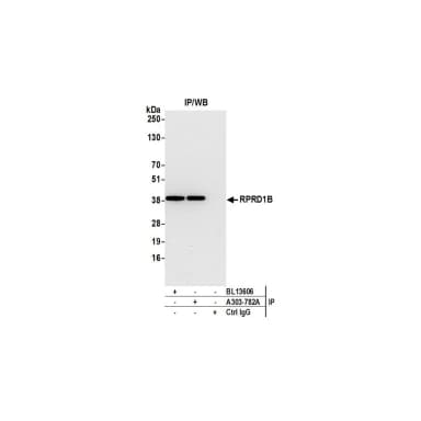 Rabbit anti-RPRD1B Antibody, Affinity Purified