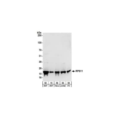 Rabbit anti-RPS11 Antibody, Affinity Purified