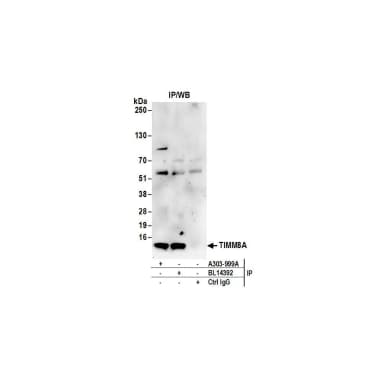 Rabbit anti-TIMM8A Antibody, Affinity Purified