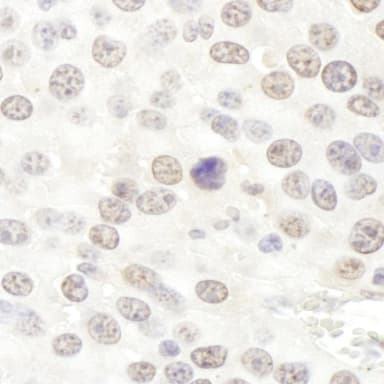 Rabbit anti-NHP2L1 Antibody, Affinity Purified