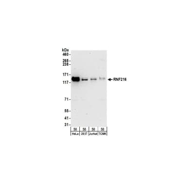 Rabbit anti-RNF216 Antibody, Affinity Purified