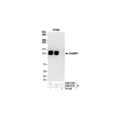 Rabbit anti-CHAMP1 Antibody, Affinity Purified