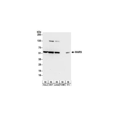 Rabbit anti-WARS Antibody, Affinity Purified
