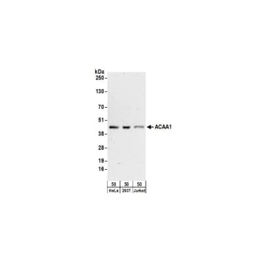 Rabbit anti-ACAA1 Antibody, Affinity Purified