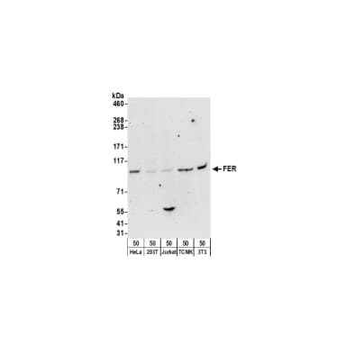 Rabbit anti-FER Antibody, Affinity Purified