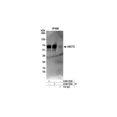 Rabbit anti-ASCT2 Antibody, Affinity Purified