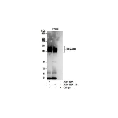 Rabbit anti-SEMA4D Antibody, Affinity Purified
