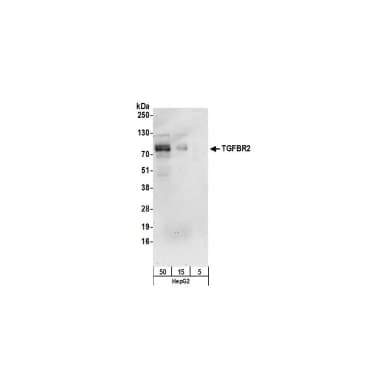 Rabbit anti-TGFBR2 Antibody, Affinity Purified