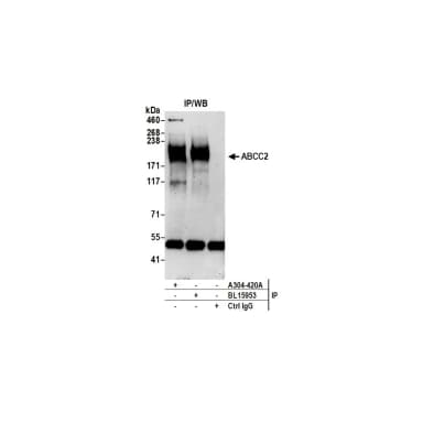 Rabbit anti-ABCC2 Antibody, Affinity Purified
