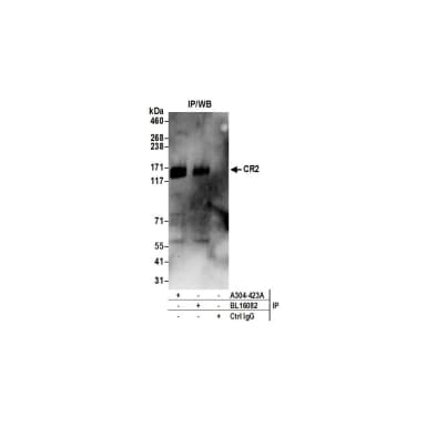Rabbit anti-CR2 Antibody, Affinity Purified