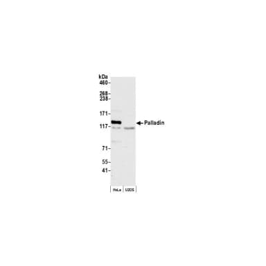 Rabbit anti-Palladin Antibody, Affinity Purified