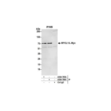 Rabbit anti-MYCL1/L-Myc Antibody, Affinity Purified
