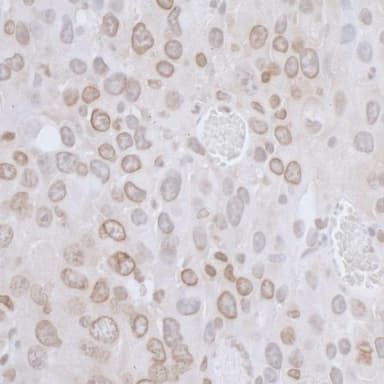 Rabbit anti-LAP2 beta/TMPO Antibody, Affinity Purified