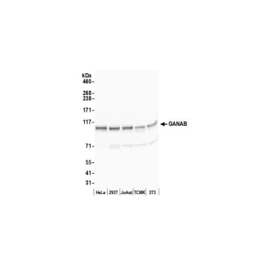Rabbit anti-GANAB/Glucosidase II Subunit alpha Antibody, Affinity Purified