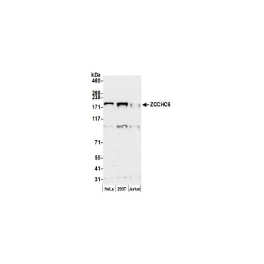 Rabbit anti-ZCCHC6 Antibody, Affinity Purified