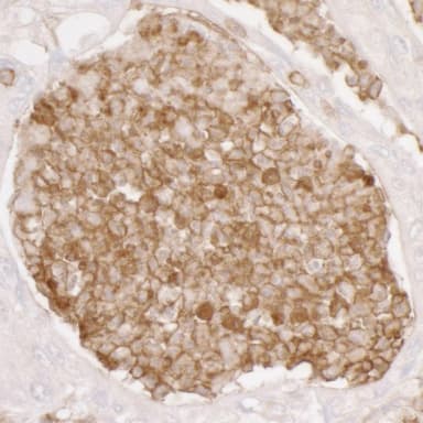 Rabbit anti-ANXA1/Annexin A1 Antibody, Affinity Purified