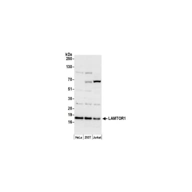 Rabbit anti-LAMTOR1 Antibody, Affinity Purified