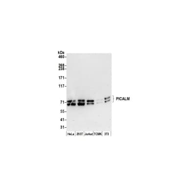 Rabbit anti-PICALM/CALM Antibody, Affinity Purified
