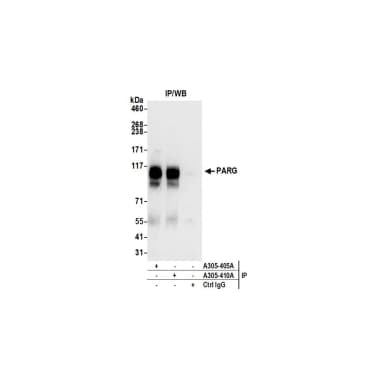 Rabbit anti-PARG Antibody, Affinity Purified