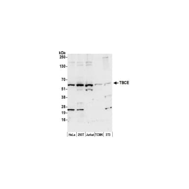 Rabbit anti-TBCE Antibody, Affinity Purified