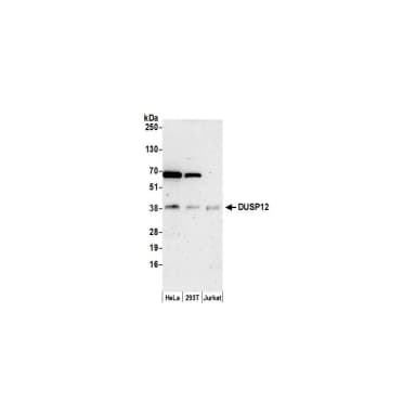 Rabbit anti-DUSP12 Antibody, Affinity Purified