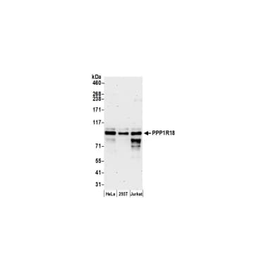 Rabbit anti-PPP1R18 Antibody, Affinity Purified