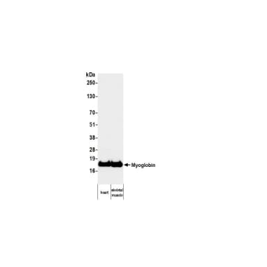 Mouse anti-Myoglobin Monoclonal Antibody [5mb-64]