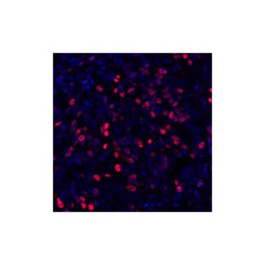 Rabbit anti-Ki-67 Recombinant Monoclonal Antibody [BLR021E]