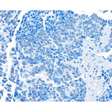Rabbit anti-BRD3 Recombinant Monoclonal Antibody [BLR069G]
