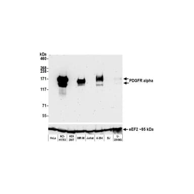 Rabbit anti-PDGFR alpha Recombinant Monoclonal Antibody [BLR078G]
