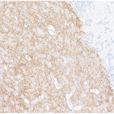 Rabbit anti-Tyrosine Hydroxylase Recombinant Monoclonal Antibody [BLR155J]