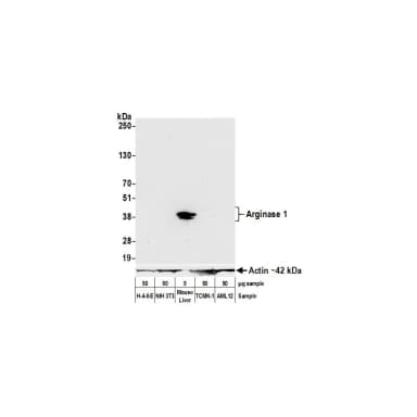 Rabbit anti-Arginase 1 Recombinant Monoclonal Antibody [BLR161J]