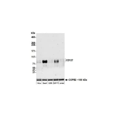 Rabbit anti-CD127/IL-7R alpha Recombinant Monoclonal Antibody [BLR177J]