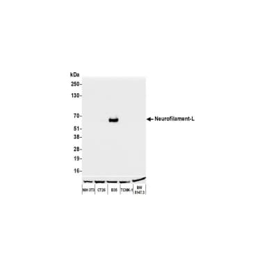 Rabbit anti-Neurofilament-L Recombinant Monoclonal Antibody [BLR224K]