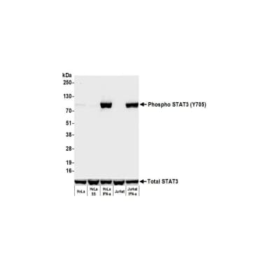 Rabbit anti-STAT3-pY705 Recombinant Monoclonal Antibody [BLR231K]
