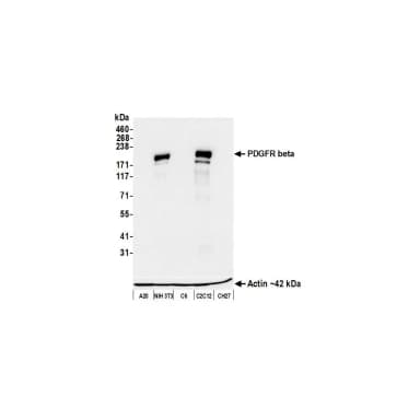 Rabbit anti-PDGFR beta Recombinant Monoclonal Antibody [BLR242L]
