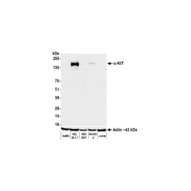 Rabbit anti-c-Kit Recombinant Monoclonal Antibody [BLR263L]