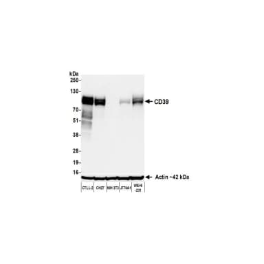 Rabbit anti-CD39 Recombinant Monoclonal Antibody [BLR285L]