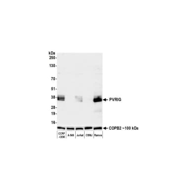 Rabbit anti-PVRIG Recombinant Monoclonal Antibody [BLR296L]