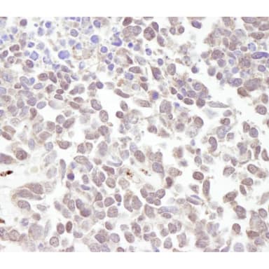 Rabbit anti-MTA1 IHC Antibody, Affinity Purified