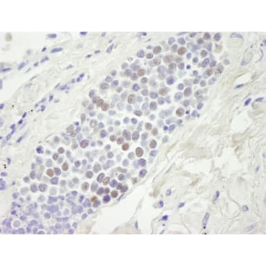 Goat anti-MCM4 IHC Antibody, Affinity Purified
