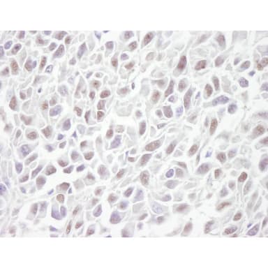 Rabbit anti-SMC3 IHC Antibody, Affinity Purified