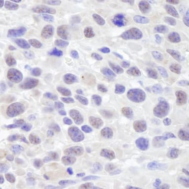 Rabbit anti-ASH2 IHC Antibody, Affinity Purified