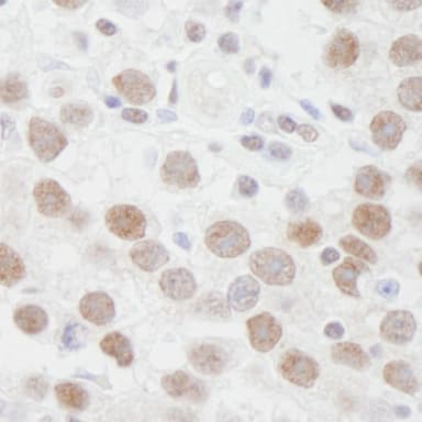 Rabbit anti-DDX1 IHC Antibody, Affinity Purified