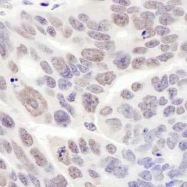 Rabbit anti-REST IHC Antibody, Affinity Purified