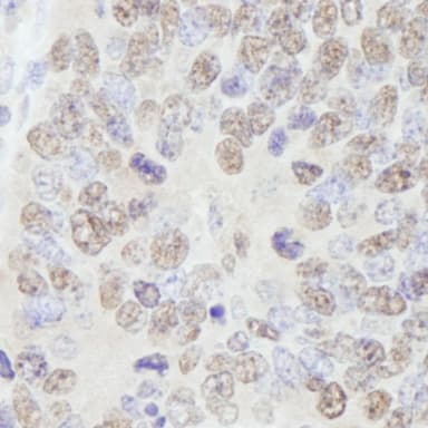 Rabbit anti-AKAP8/AKAP95 IHC Antibody, Affinity Purified