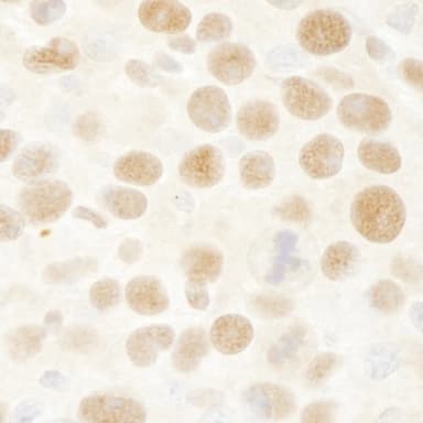 Rabbit anti-RbBP4 IHC Antibody, Affinity Purified